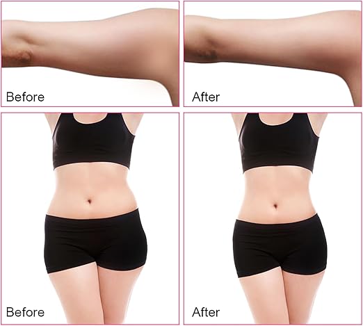 Image for Phyzioline Cavitation Machine