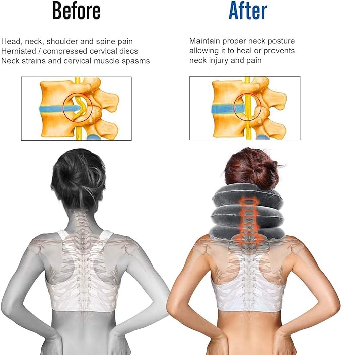 Image for M PAIN MANAGEMENT TECHNOLOGIES Neck Traction with Ratchet Tight by Theratrac Glide - Cervical Traction - Stretch and Relieve Pain@@ Cervicalgia@@ Degeneration of disc@@ Spondylosis and Spine Alignment