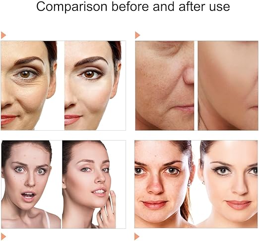 Image for 6 Color LCD Face Skin Care Light Machine With Spray, 178 Light Chips Foldable Facial Beauty Device for Beauty Salon(US Plug)